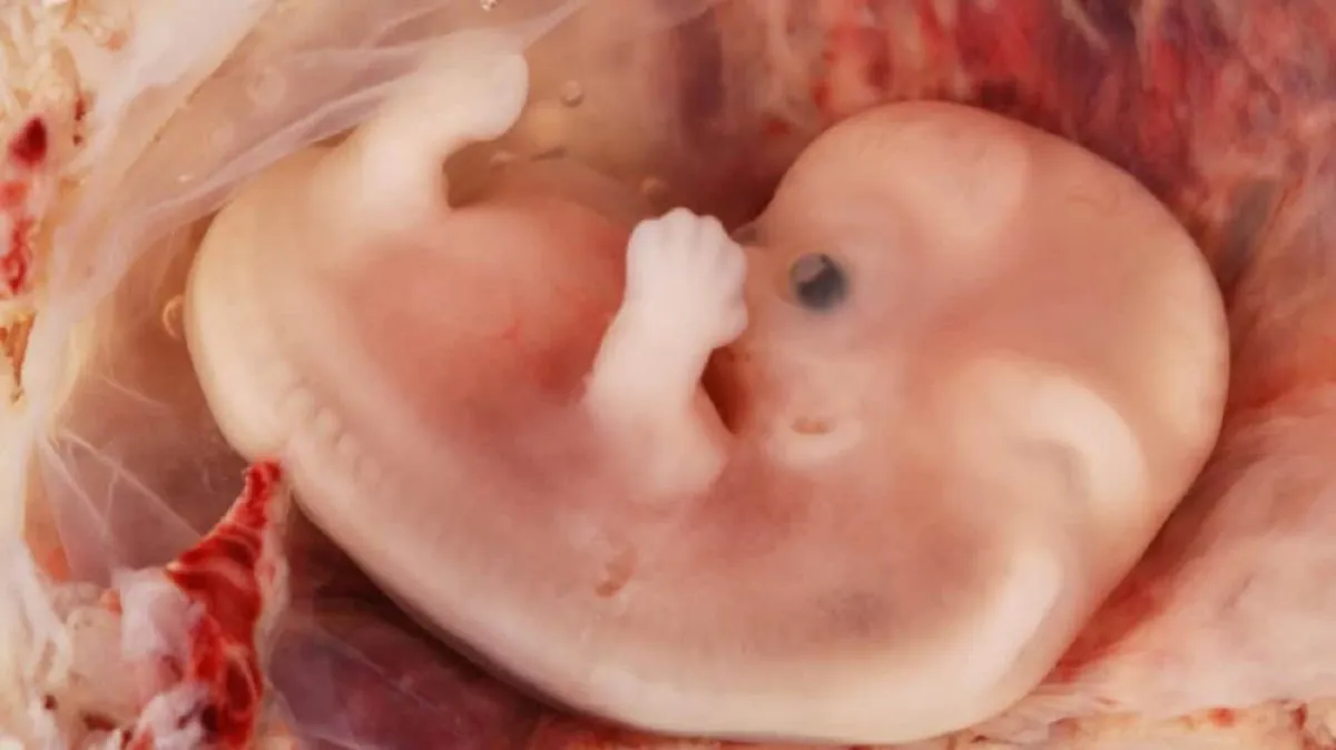 Familiares demandan a Texas por la muerte de una mujer a la que se le negó un aborto