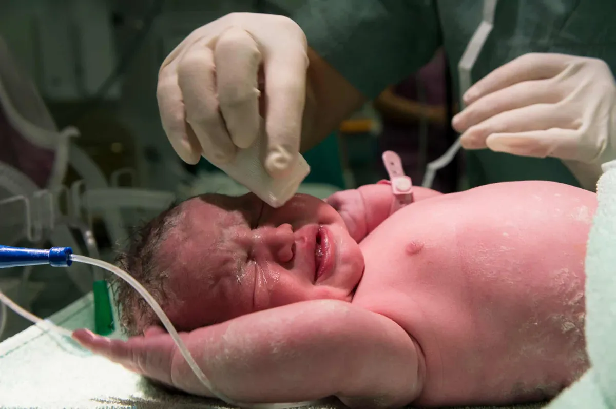 Parto vaginal o cesárea: beneficios y riesgos de las diferentes formas de dar a luz